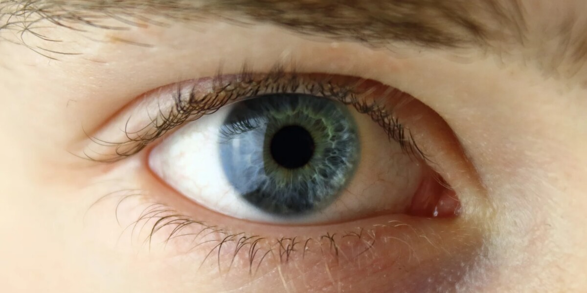 ¿Por qué nunca debes tallarte los ojos? Tips para cuidarlos